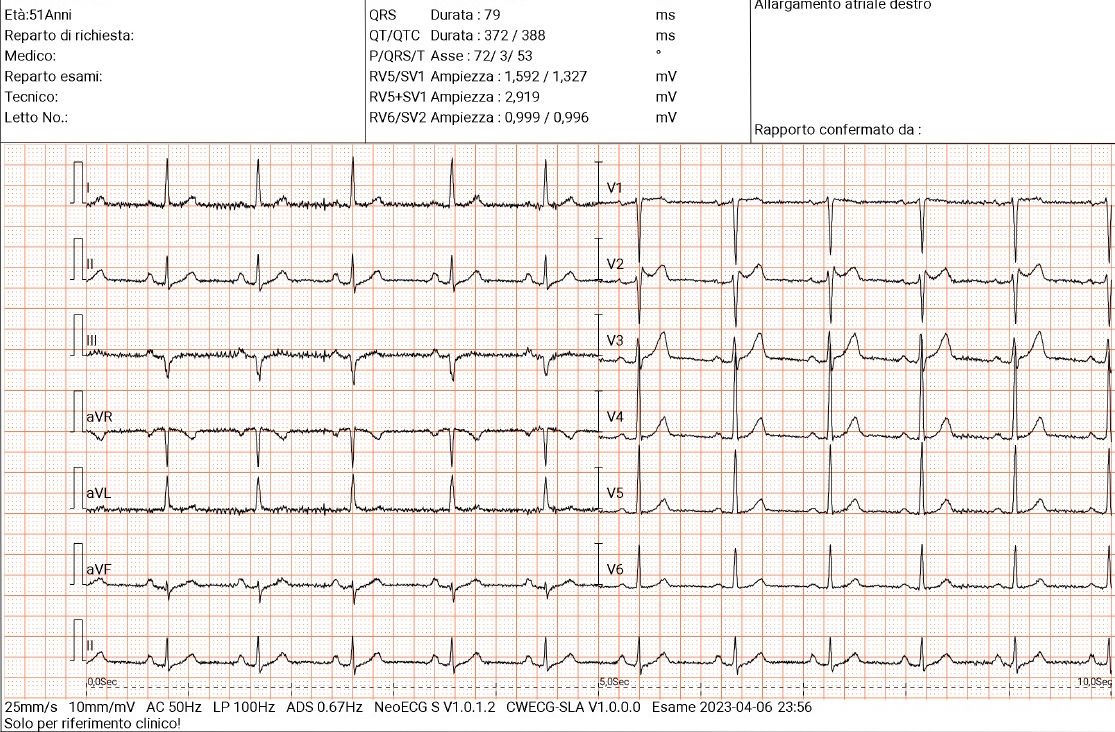 immagine ECG.jpg